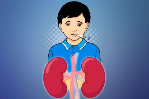 jurus pemerintah percepat penanganan kasus gagal ginjal akut gre